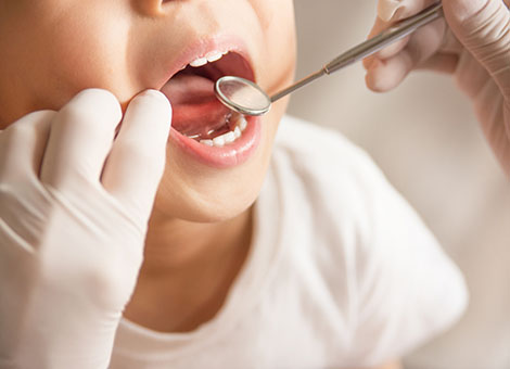 小児歯科・矯正について